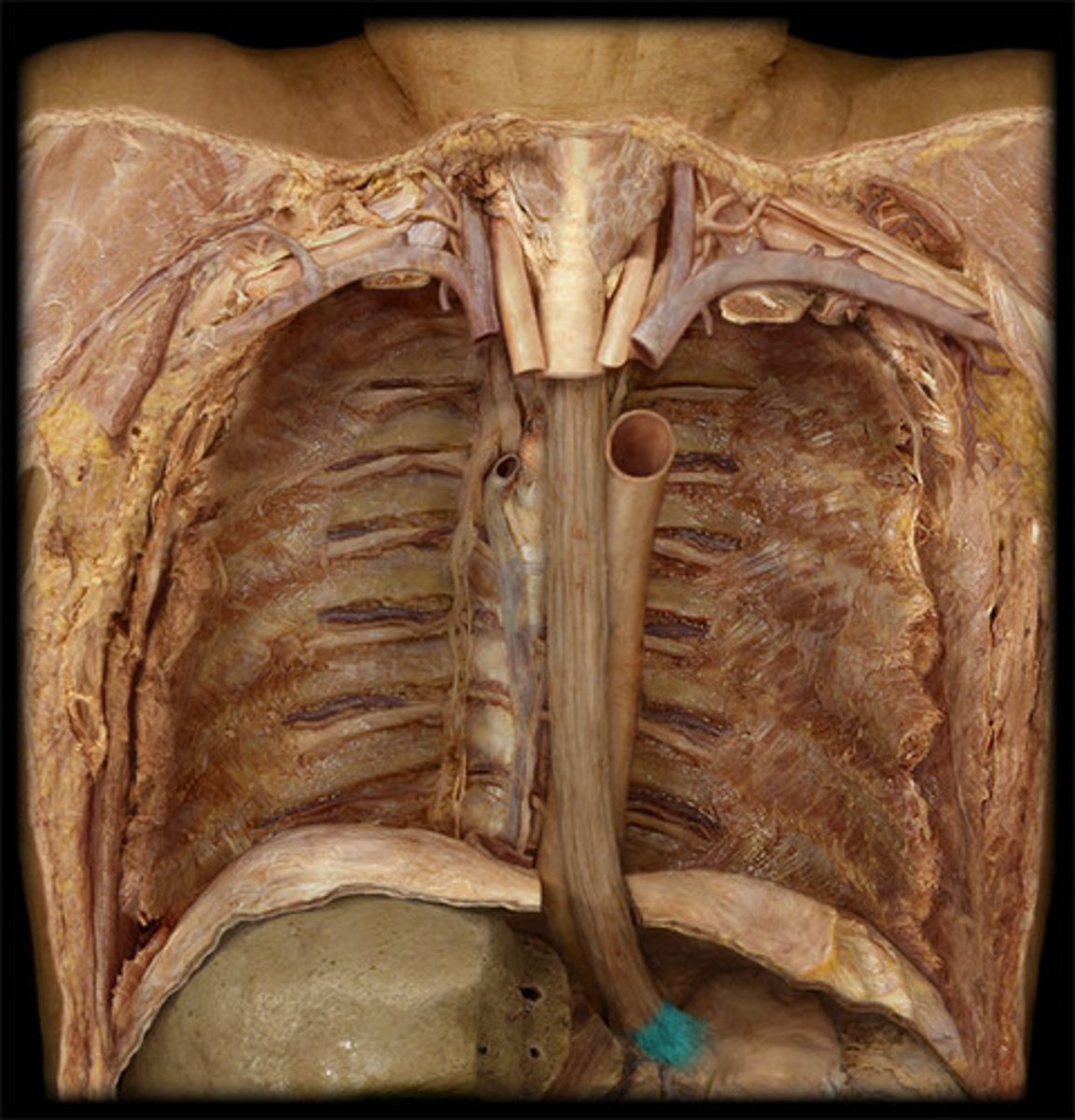 <p>The portion of the esophagus located in the abdominal cavity.</p>