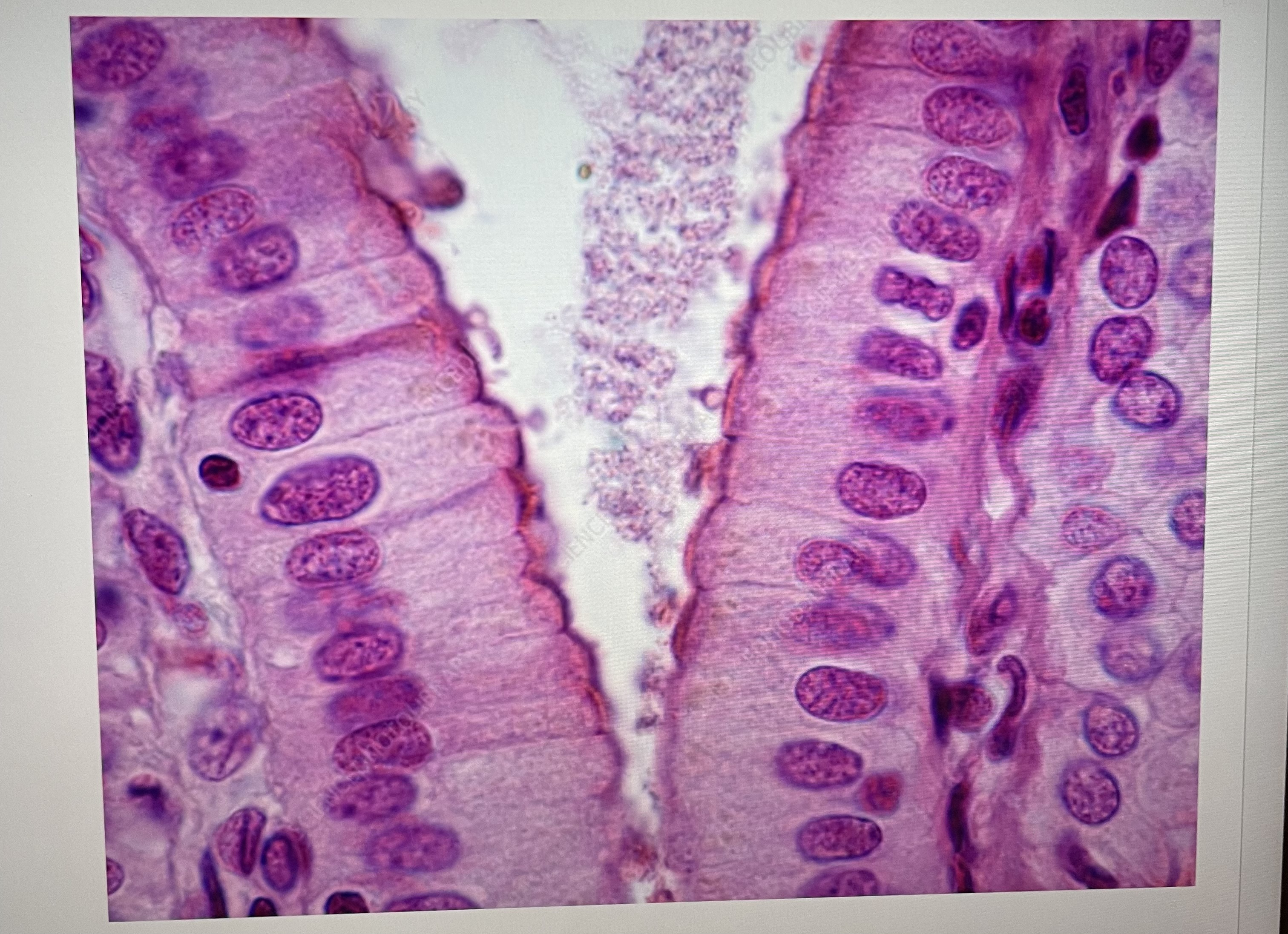 The cells of the intestinal lining pictured above is an example of 