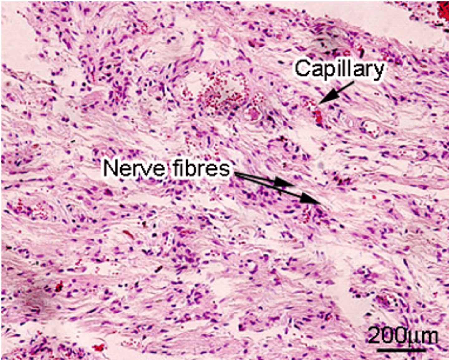 <p>How does the Posterior Pituitary/NEUROhypophysis appear histologically?</p>
