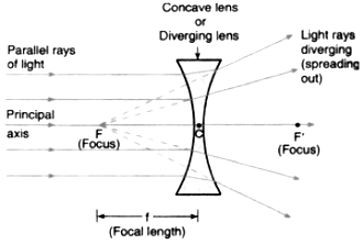 has at least one concave surface, is thinner in the center, used to correct myopia