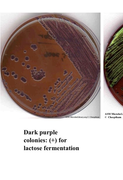 <p>What does purple indict for EMB</p>