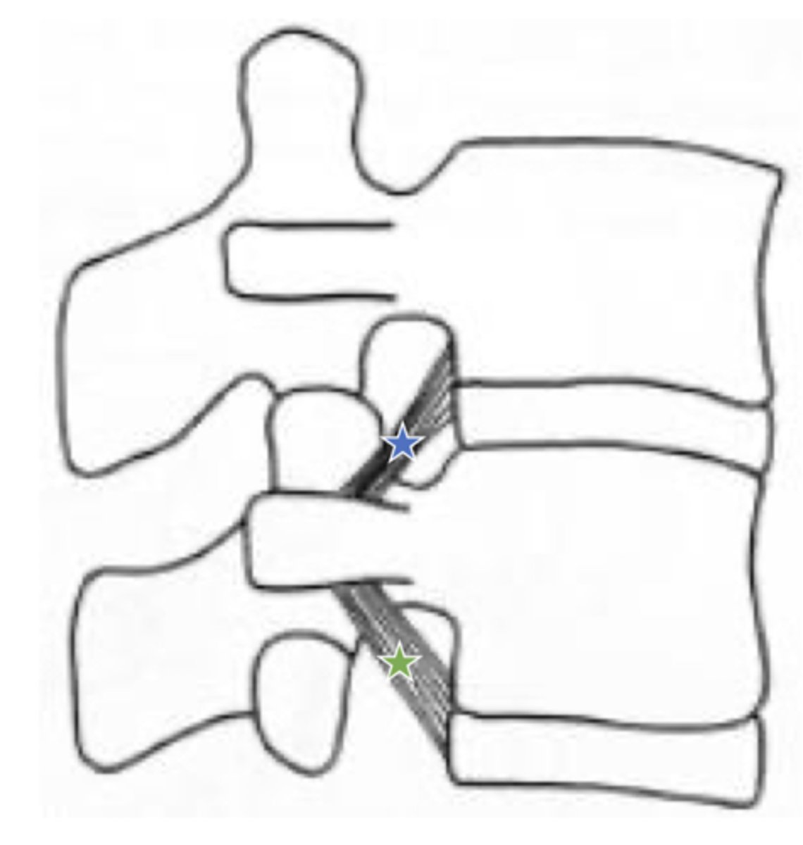 <p>superior corporotransverse ligaments (blue star in image)</p>