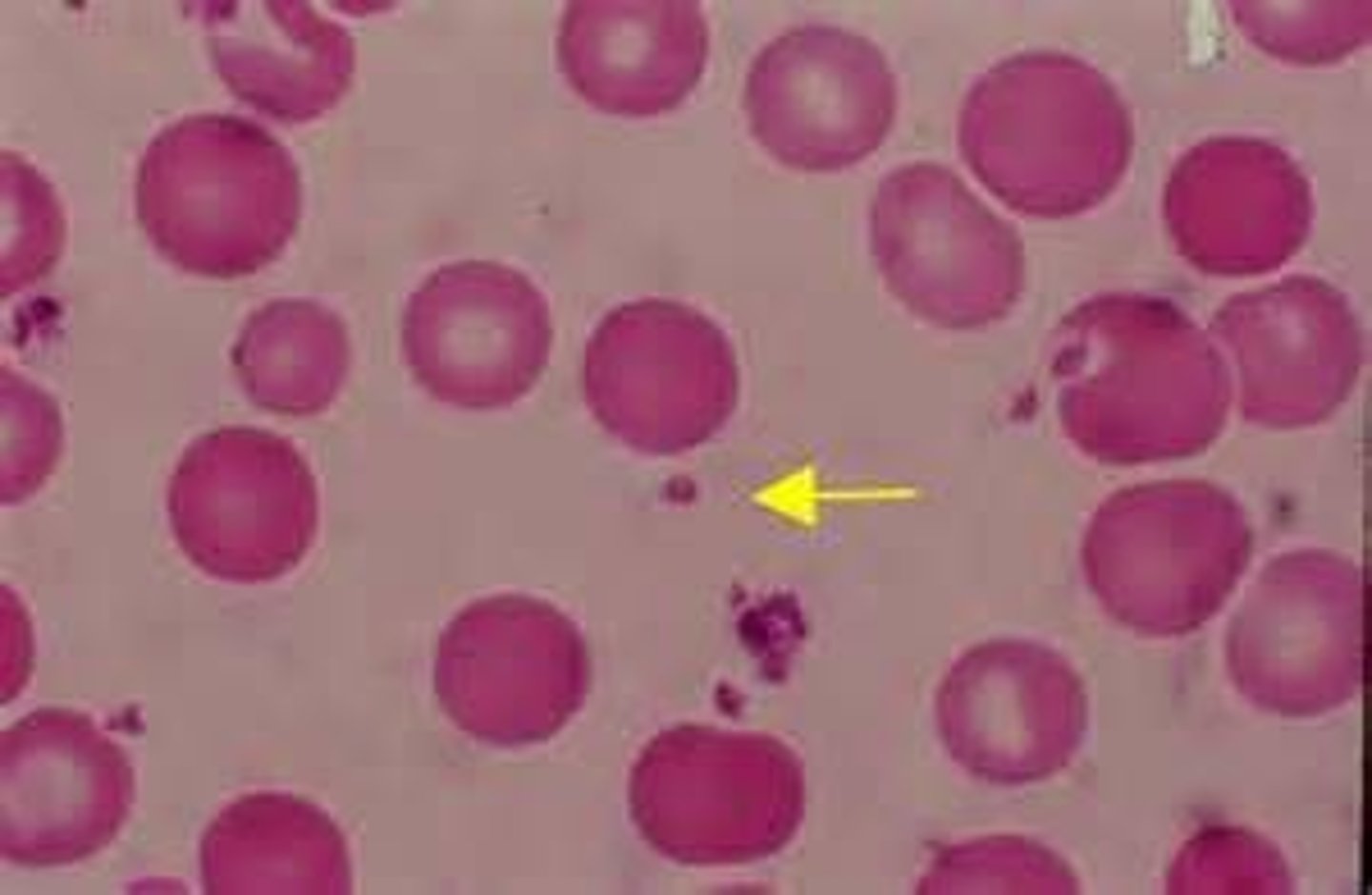 <p>part of the blood that helps it clot to form scabs</p>