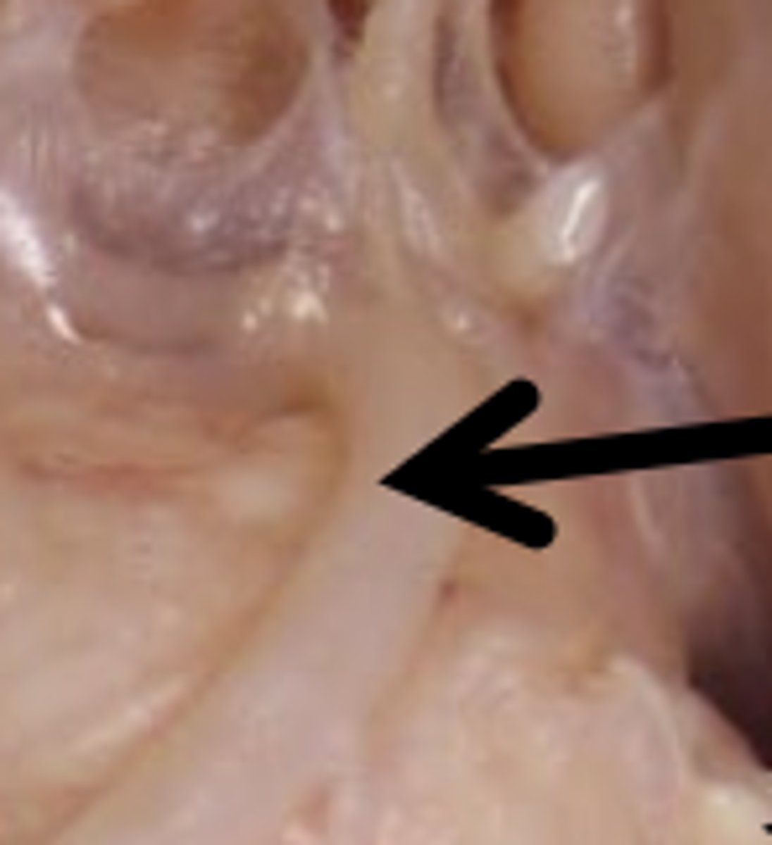 <p>confluence of two vertebral arteries and main supply to cerebellum and brainstem</p>