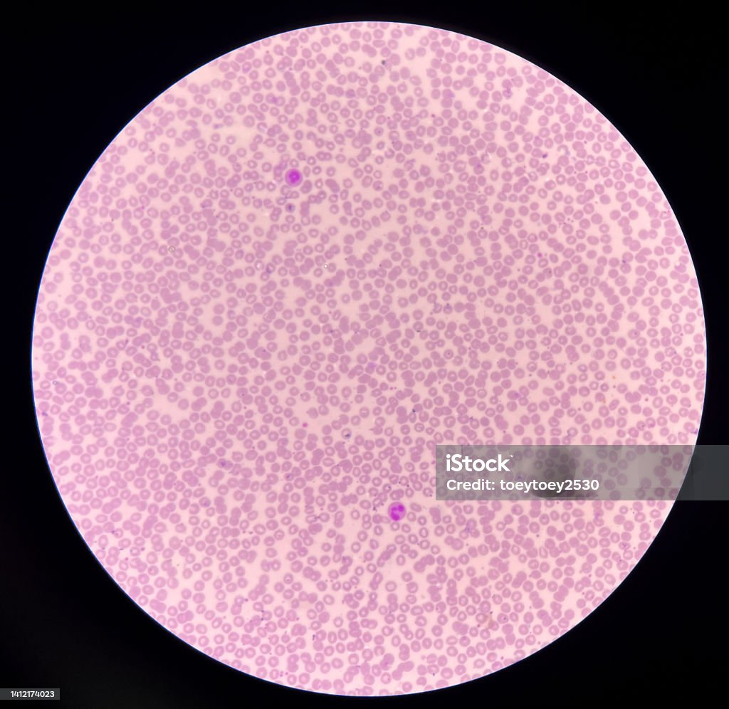 <p>What magnification level are the Red Blood Cells? </p>