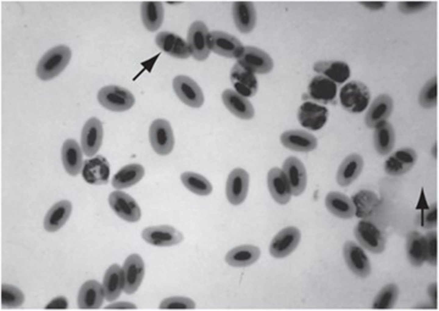 <p>______________ causes a displacement of the nucleus in the red blood cells of birds. This</p><p>protozoan causes avian malaria.</p>