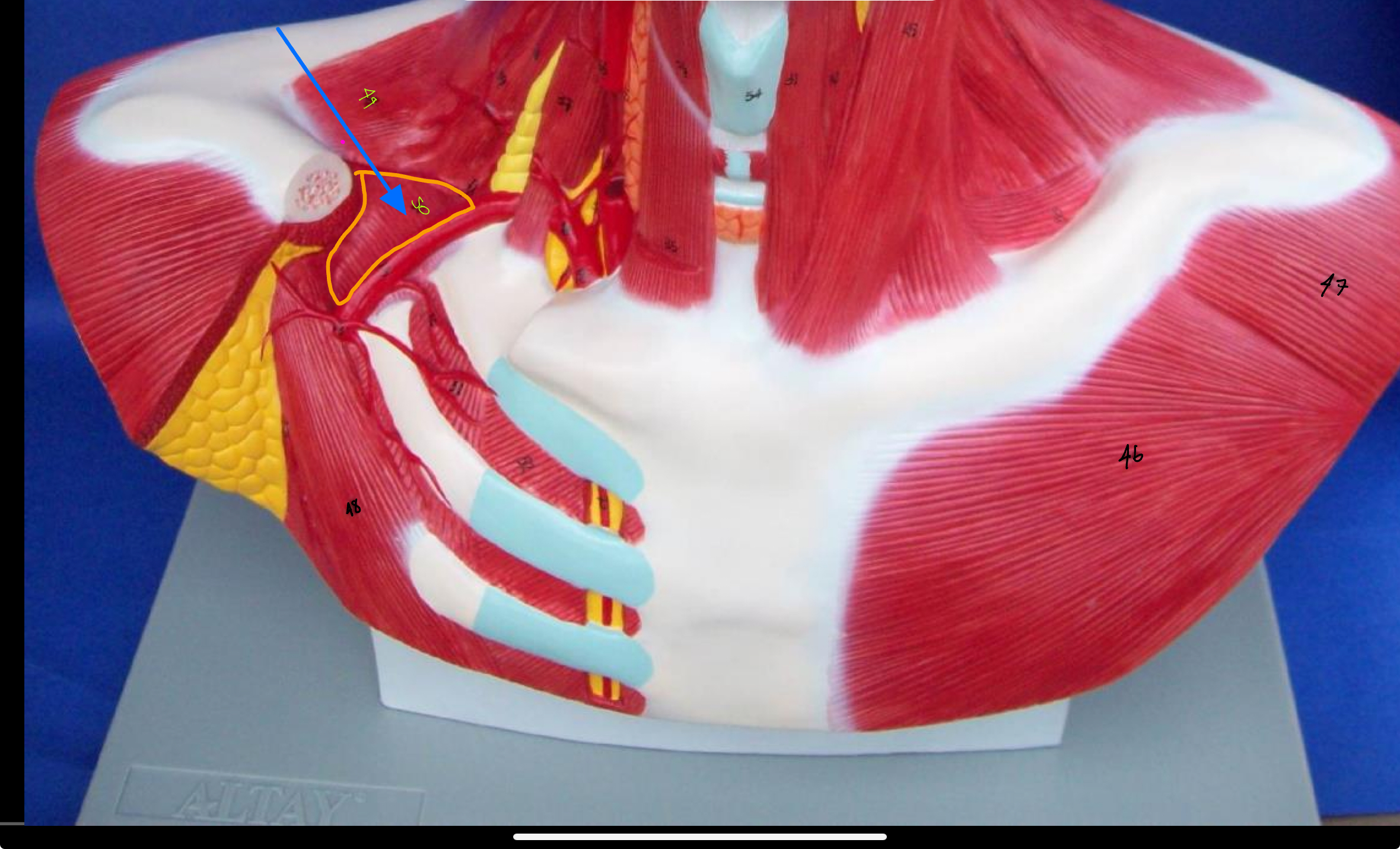 <p>What type of muscle is this (altay model)</p>