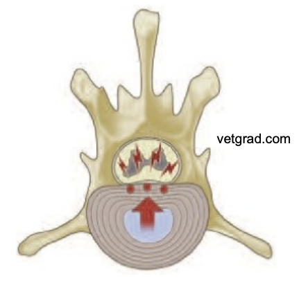 <p><strong><u>non compressive—&gt; contrindication for sx</u></strong></p><ul><li><p>brighter, bruising but nothing else</p></li></ul><p></p><p>History: associated with a trauma or high-impact activity </p><p>Clinical signs: </p><ul><li><p><strong><u>acute onset</u></strong>, lateralised neurological deficits </p></li><li><p><strong><u>Non progressive</u></strong> after first 24 hours </p></li><li><p>Often vocalize at onset and may be painful in first 24h </p></li><li><p>Neurological signs depend on location and degree of spinal cord damage</p></li></ul><p>Pathogenesis: Sudden extrusion of <u>small volume of disc material, impacts spinal cord </u>with force </p><p>Diagnosis: MRI </p><p>Treatment:<u> Conservative </u></p><p>Prognosis: Recovery of ambulation excellent, variable recovery of continences</p><p></p>