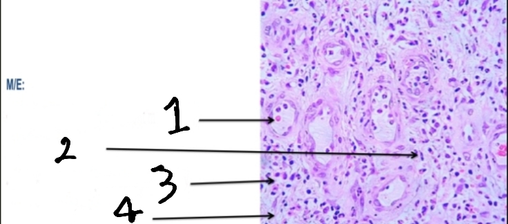 <p>For the previous question, mention the microscopic features according to numbers on photo.</p>