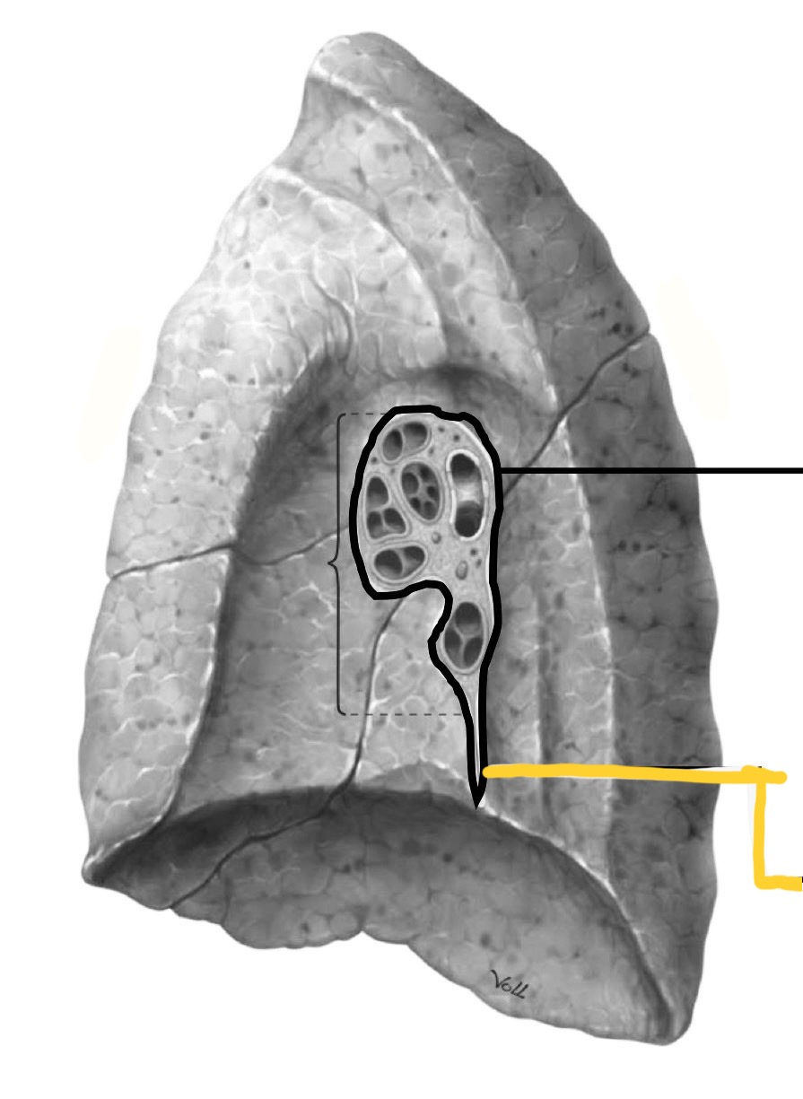 <p>What structure is identified by the yellow line?</p>
