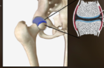 <p>protects and lubricates bones in joint</p>