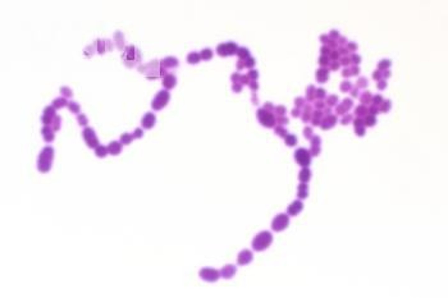 <p>A bacterium that occurs as chains of cocci</p>