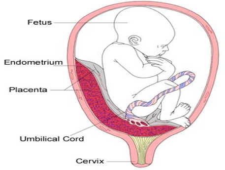 <p></p><ul><li><p>The placenta is improperly implanted in the lower uterine segment.</p></li><li><p>Placenta may cover the cervical os (opening of the cervix).</p></li><li><p>Diagnosed by ultrasound.</p></li></ul><p></p>