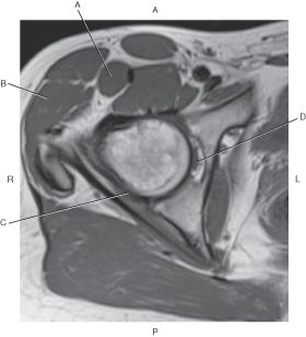 <p>Which line is pointing to the rectus femoris muscle?-</p>