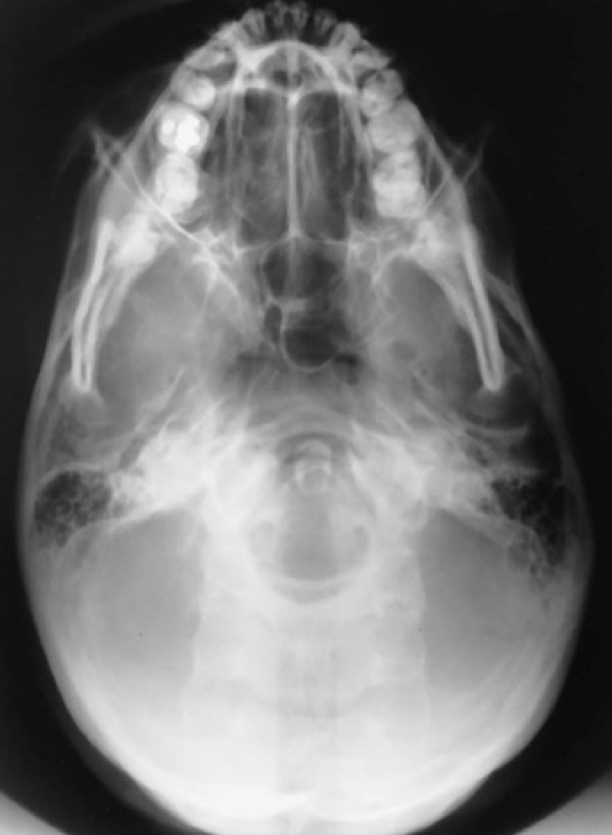 <p>Which position is this?</p>