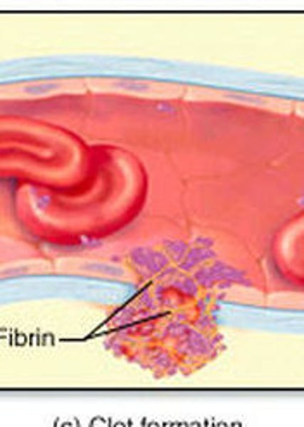 <p>Blood protects against excessive blood loss by clotting, and uses white blood cells to protect against infections</p>