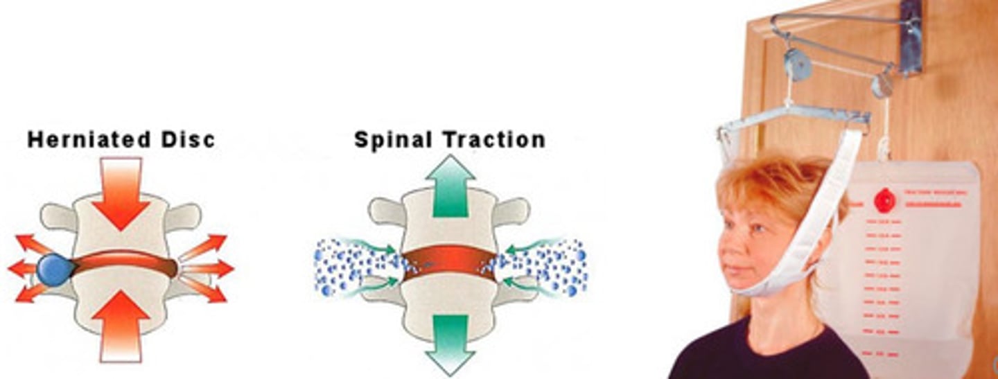 <p>decompression therapy</p>