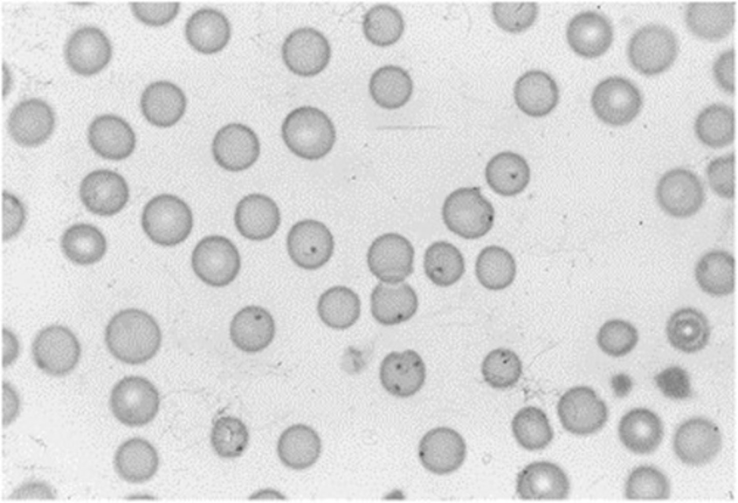 <p>This protozoan parasite of cats is found in a classic ring form in the red blood cells. It has a</p><p>poor prognosis of cure in cats and is considered a piroplasm. The genus and species is:</p>