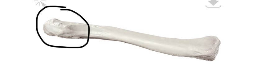 <p>Welk deel van de clavicula is dit? (links is hier mediaal)</p>