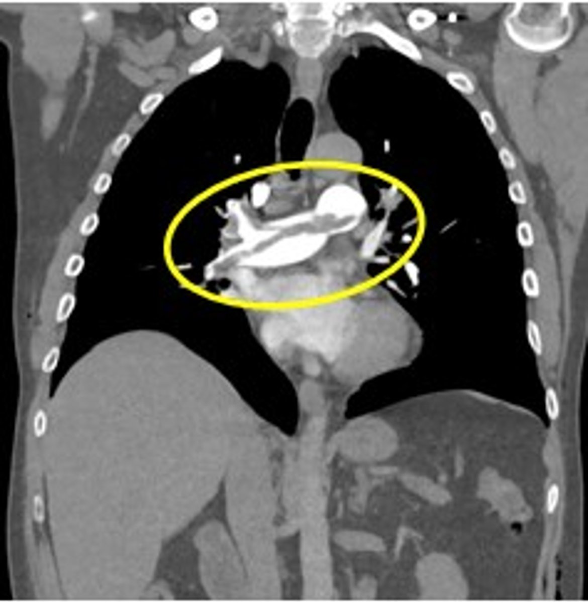 <p>Label pathology in image below</p>