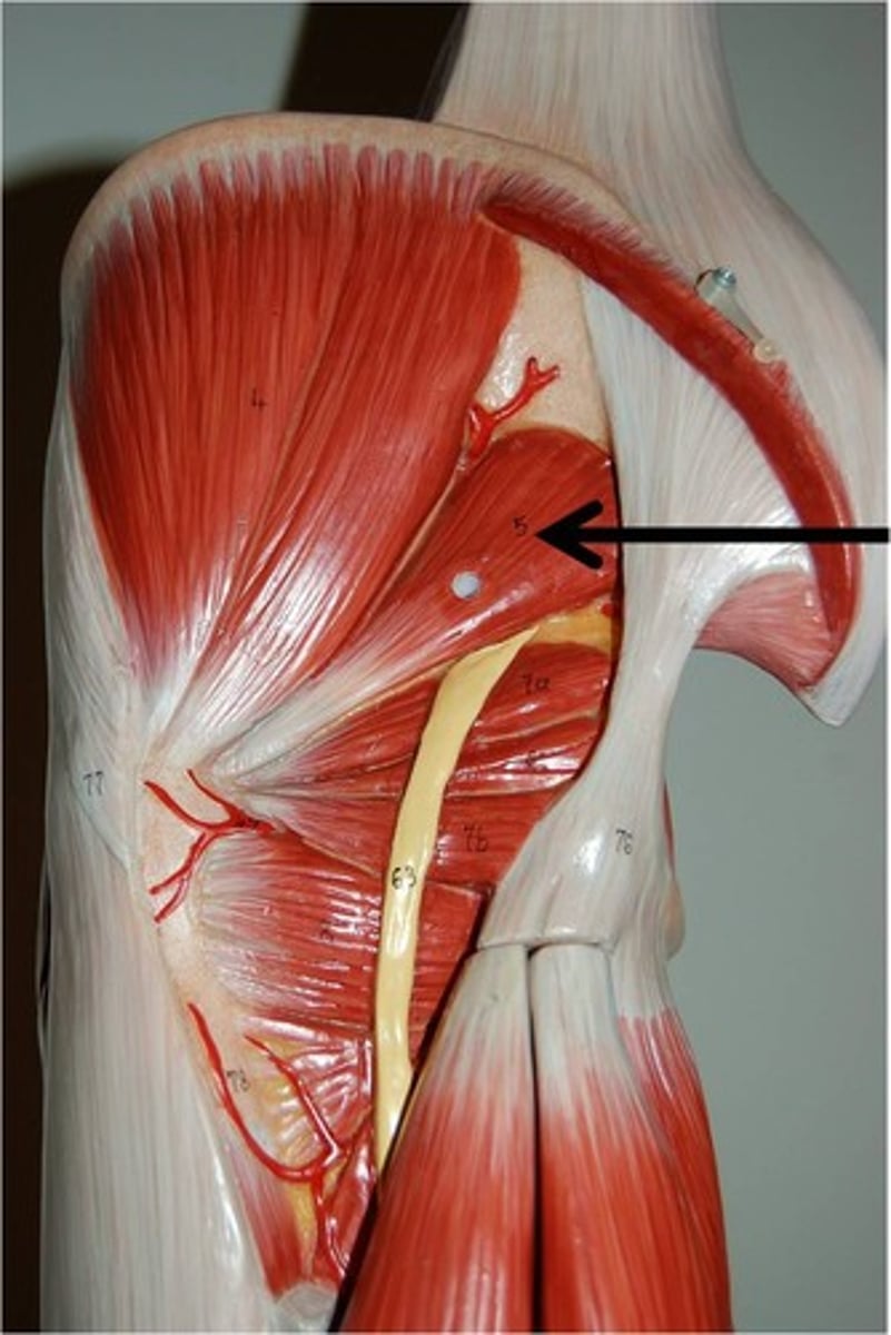 <p>Abducts and laterally rotates thigh</p>