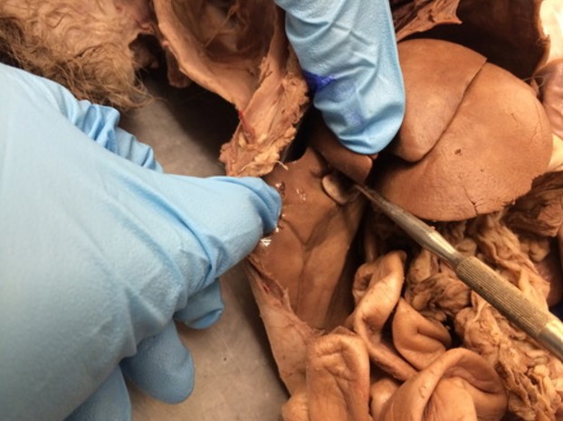 <p>What organ is being indicated in the image</p>