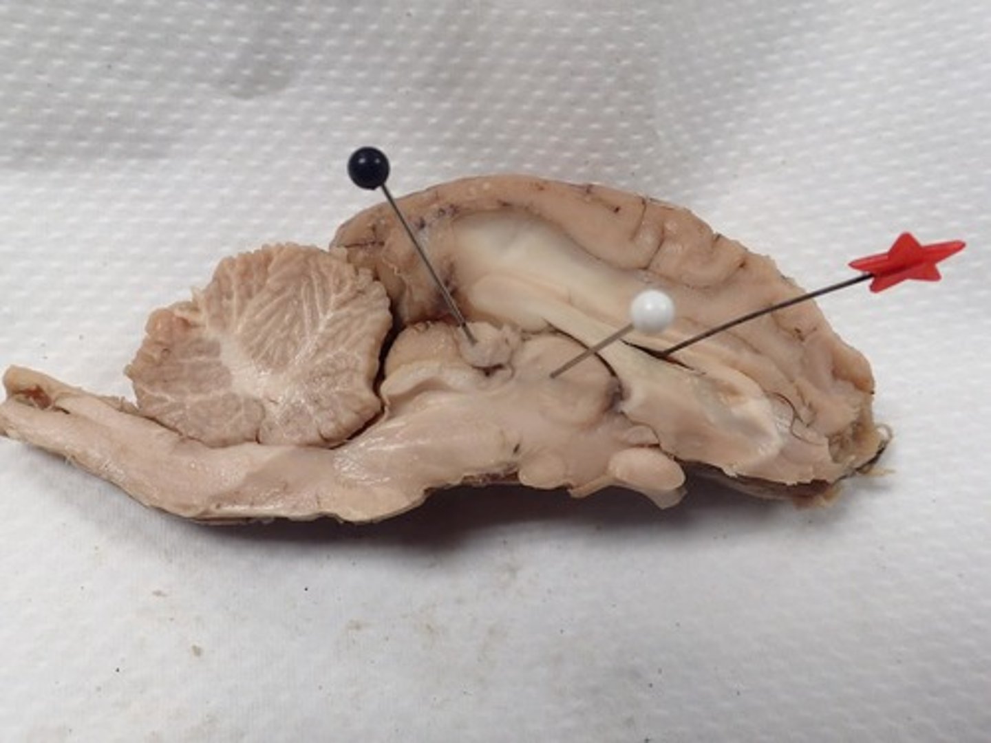<p>produces cerebrospinal fluid</p>