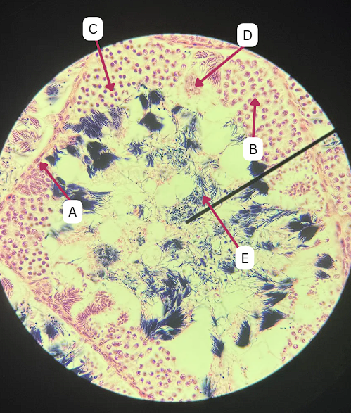 <p>TRUE OR FALSE</p><p>A is a haploid cell</p>