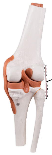 <p>What ligament is shown here?</p>