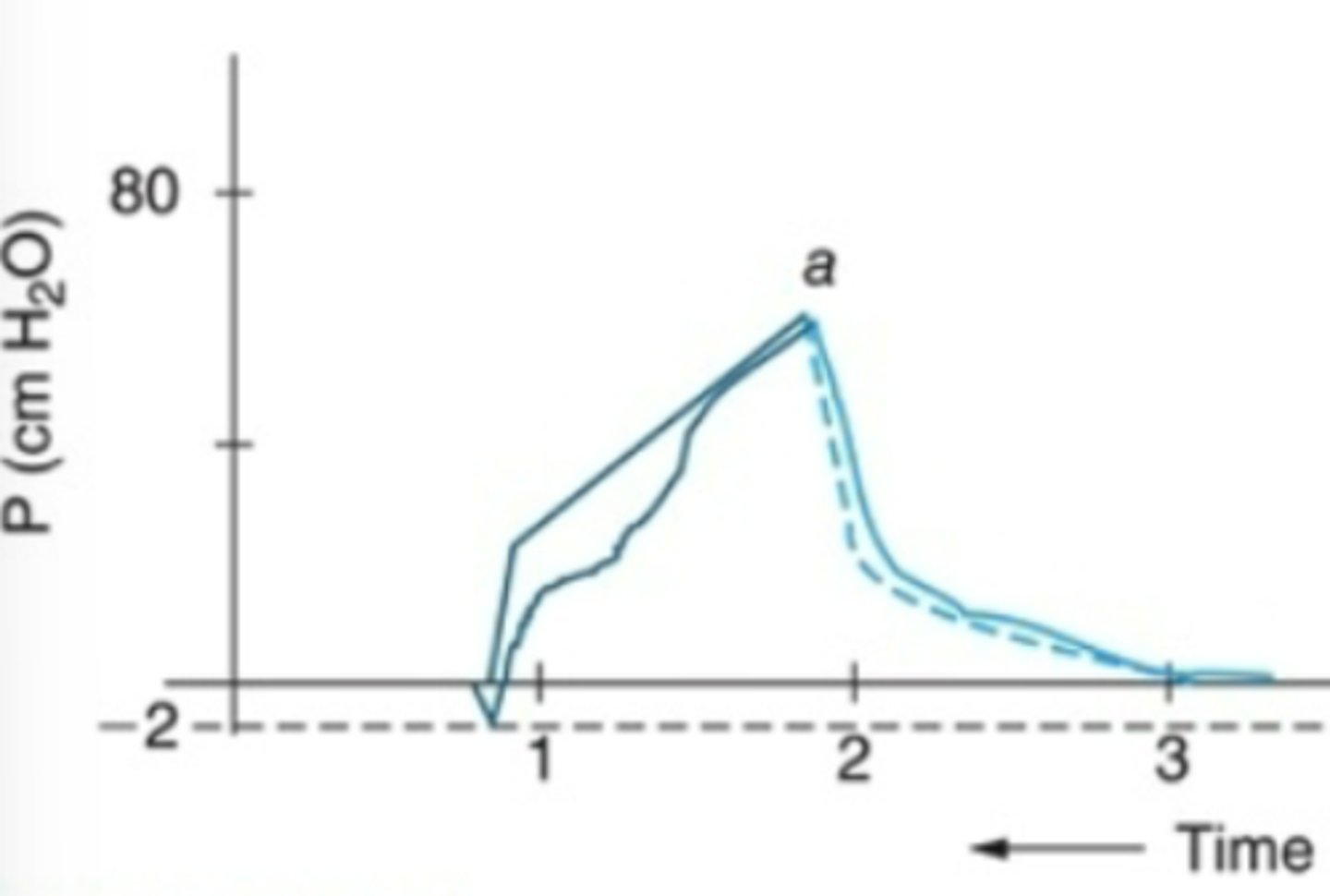 <p>inadequate inital peak flow</p>