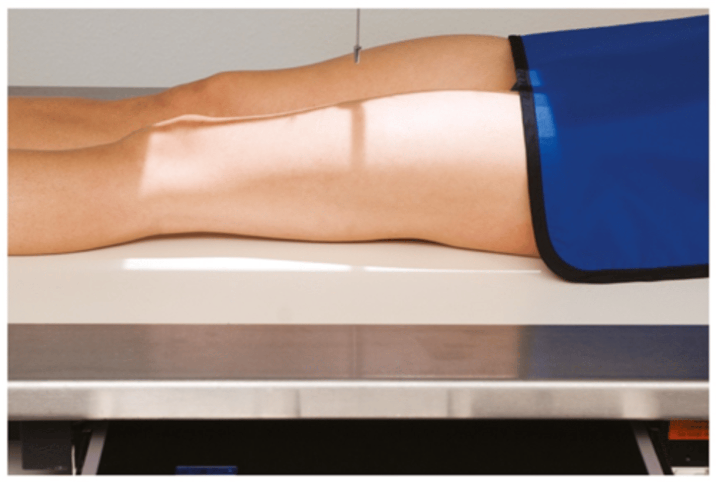 <p>1. Patient lies supine on the x-ray couch and the legs are extended.</p><p>2. Posterior aspect of the leg is in contact with the x-ray couch.</p><p>3. The IR is placed in the bucky. Make sure that the x-ray tube is locked in with the bucky system.</p><p>4. The leg is medially rotated to centralise the patella. The condyles should be equidistant to the IR.</p><p>If it is not possible to get both the hip and knee joint on the same IR, then this exposure should be hip down and then a second IR to do an 'out of bucky' knee up exposure.</p>