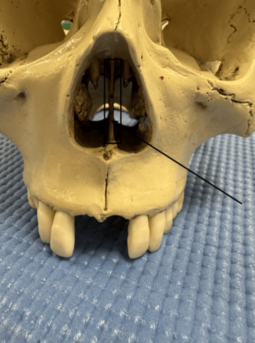 knowt flashcard image