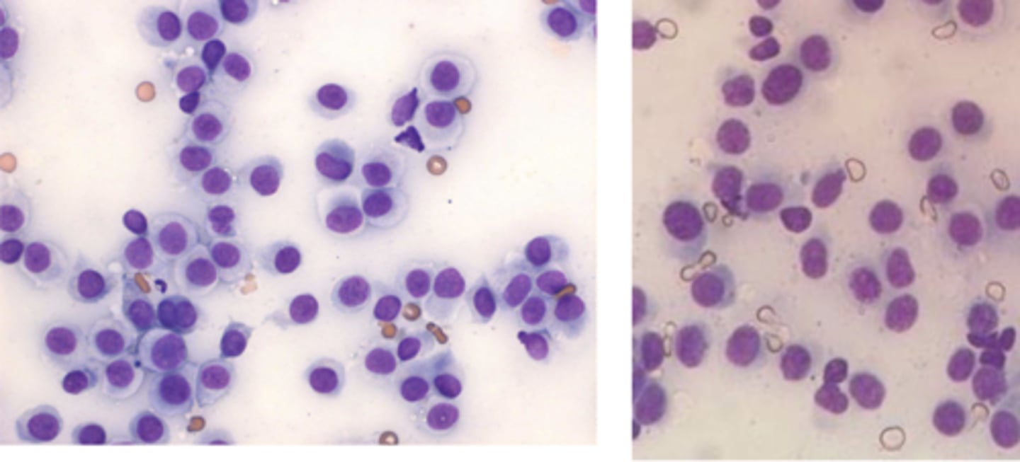<p>What type of round cell tumor is this cytology from?</p>