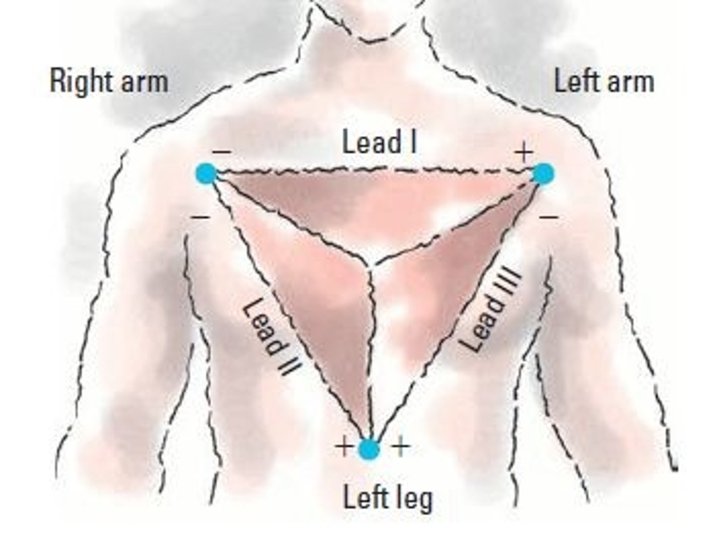 <p>shows basic EKG reading</p>