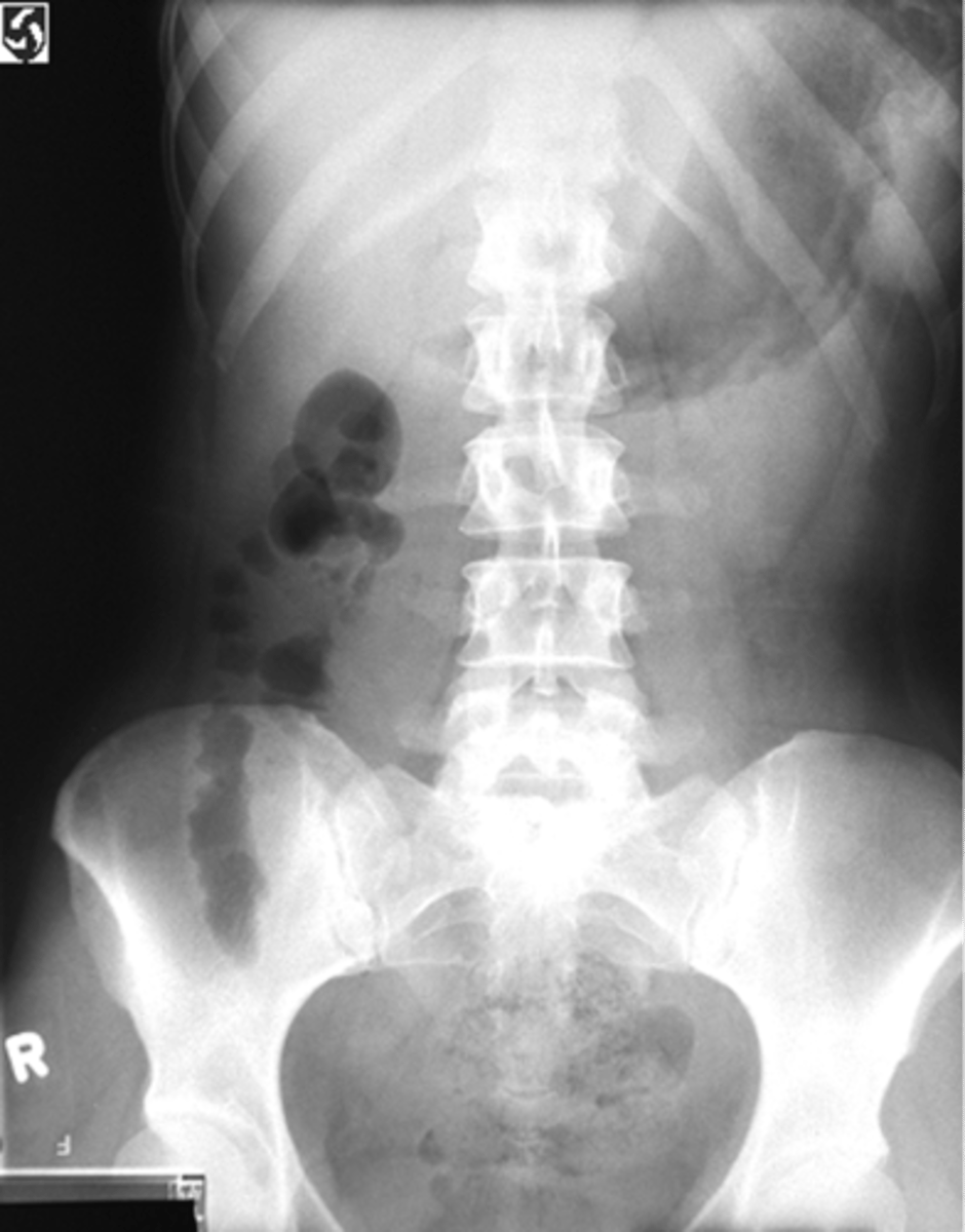 <p>What position is the patient in?</p>