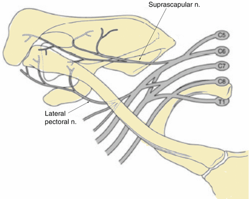 <p>lateral pectoral nerve</p><p>axillary nerve</p><p>lateral supraclavicular nerve</p>