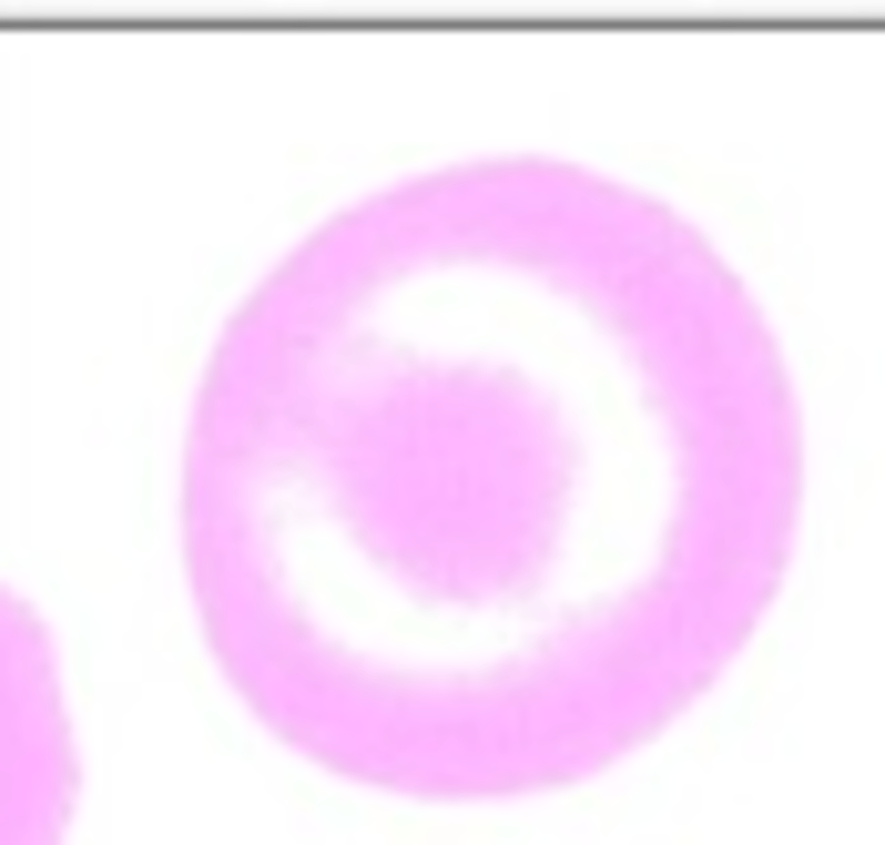 <p>What RBC morphology is this?</p>