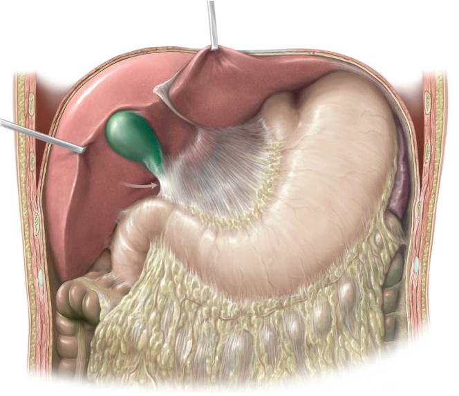 <p>mesentery</p>