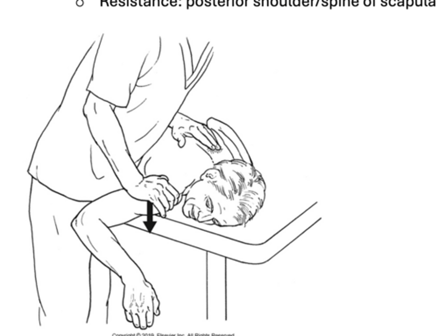 <p>Middle fibers of trapezius</p>