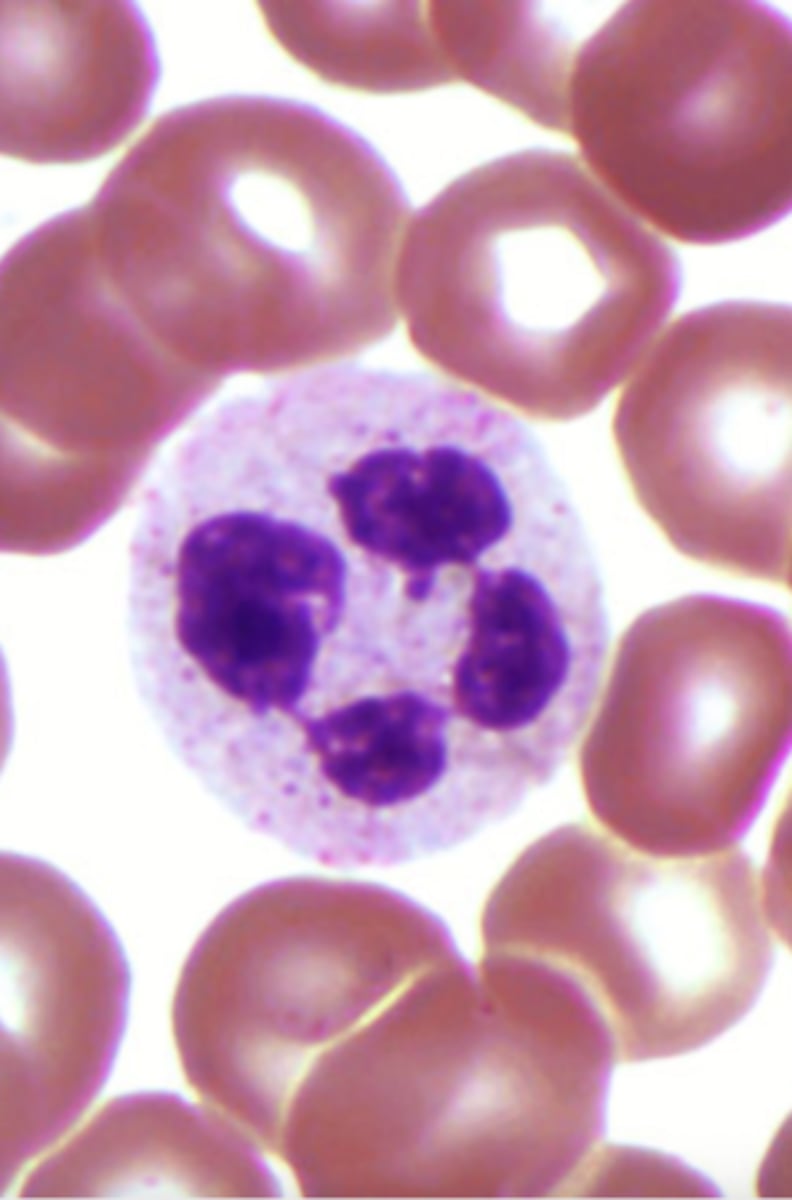 <p>What is the center cell?</p>