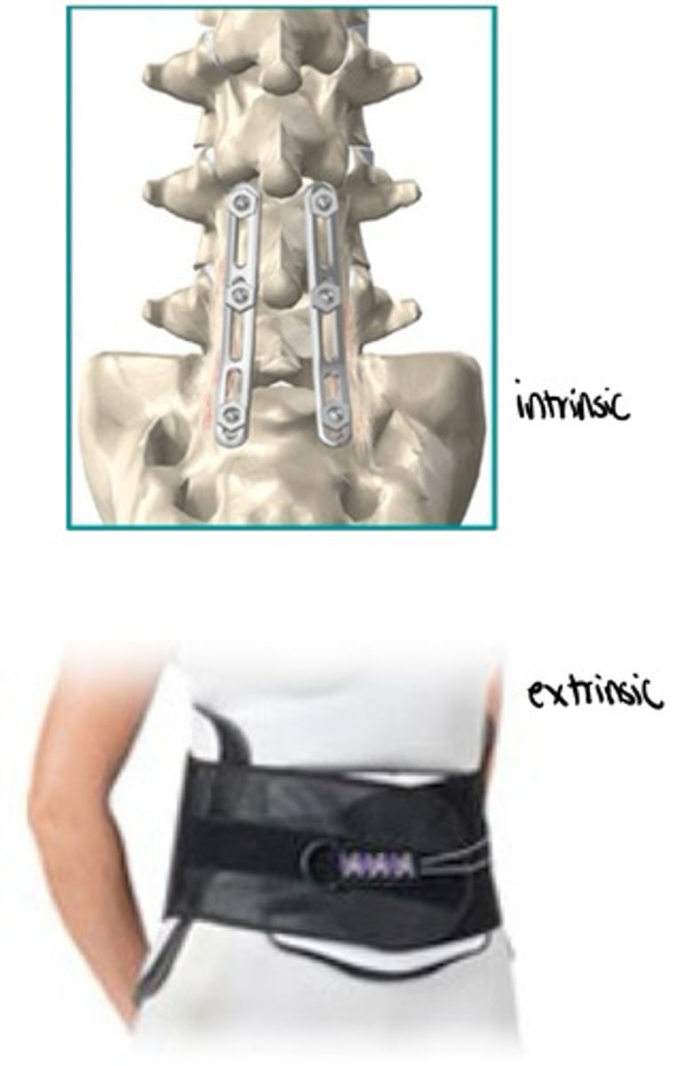 <p>increased motion at immobilization ends</p><p>vertebral joints superior and inferior to immobilization have greater demands for motion</p>