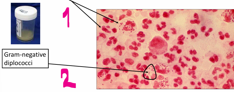 <p>Direct or indirect method of staining?</p>