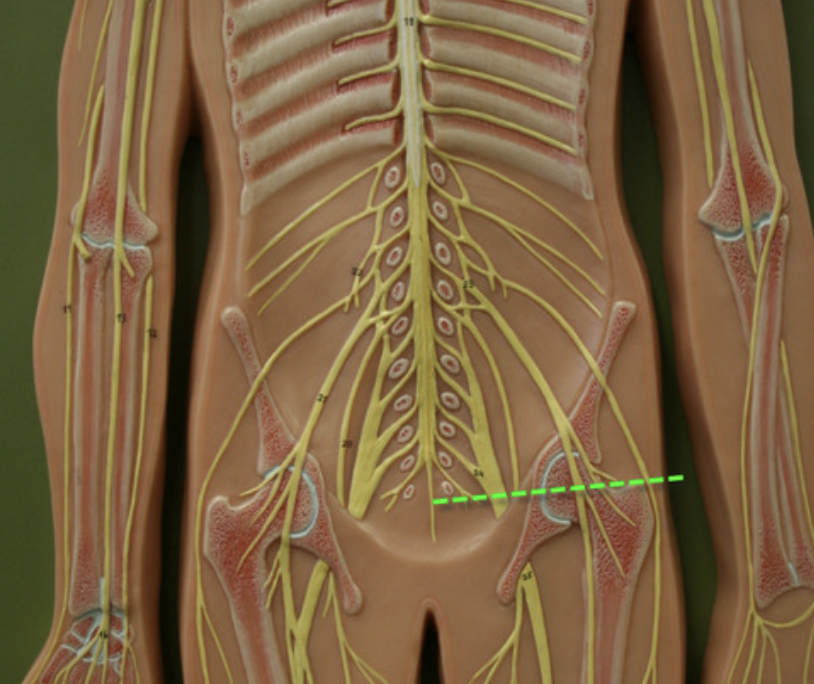 <p>fibrous extension of the pia mater; anchors the spinal cord to the coccyx</p>
