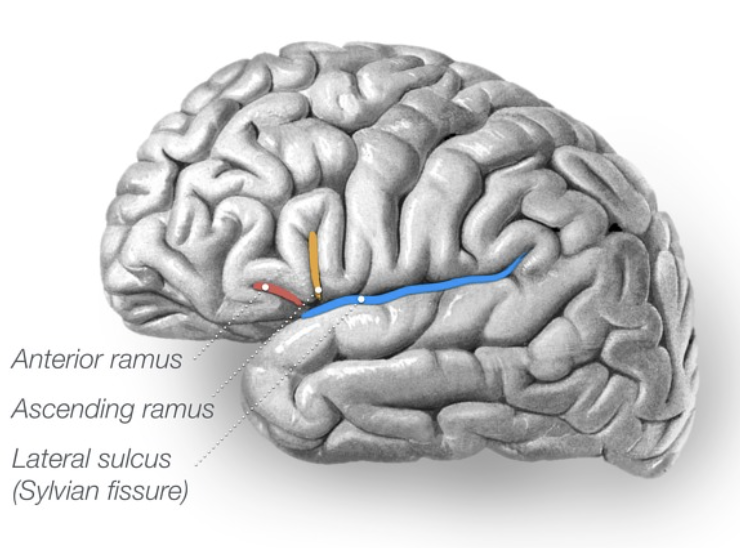 <p><span>a prominent and ancient groove in the primate brain that separates the frontal and parietal lobes from the temporal lobe</span></p>
