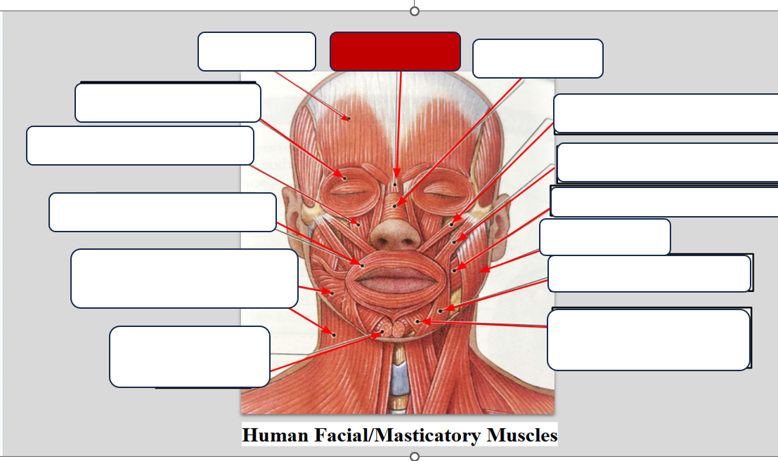 <p>Label the muscle. </p>