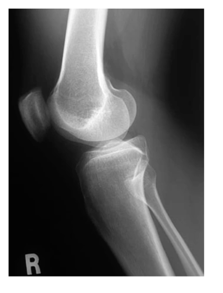 <p>State the type of view and structure being depicted.</p>