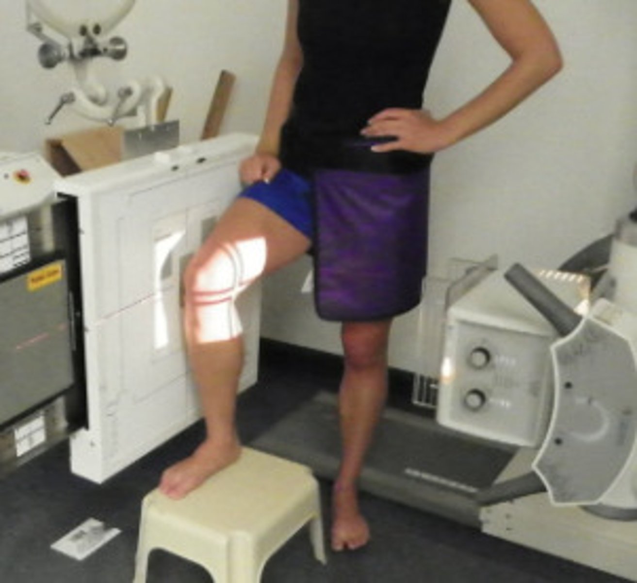 <p>1. From AP position the patient is turned towards their affected side to bring lateral aspect of lower leg into contact with the erect IR holder / erect bucky</p><p>2. The affected knee is flexed (a lunge) and the leg is turned until the lateral and medial femoral condyles are superimposed.</p>