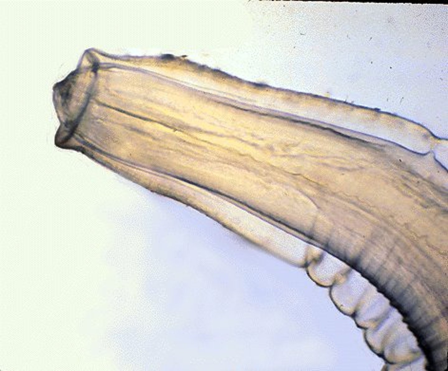 <p>What parasite is this if it is from a cat</p>