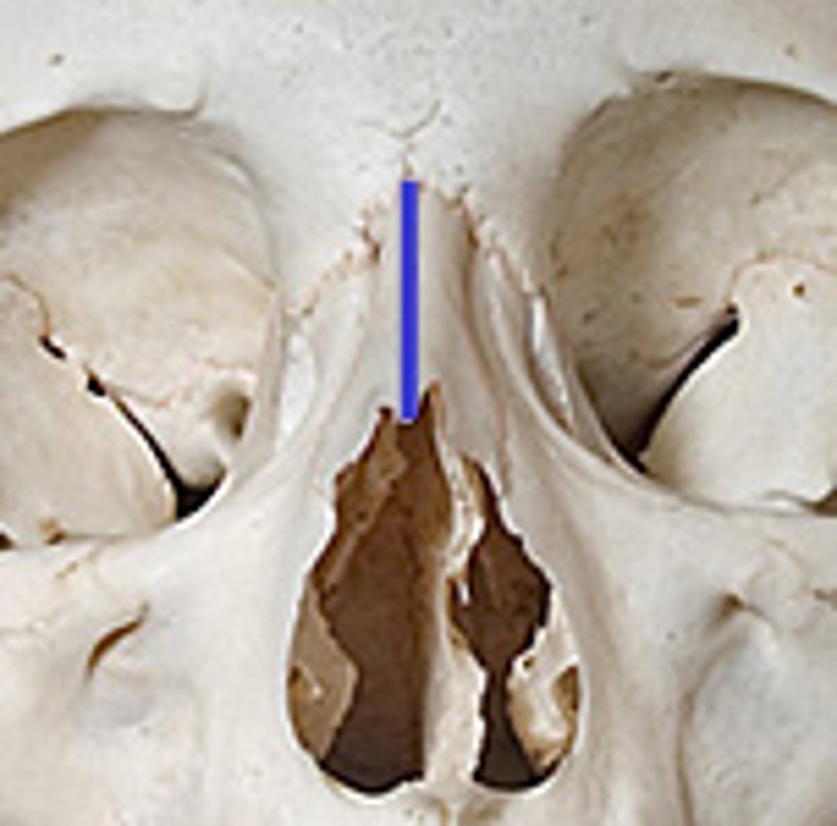 <p><em>identify the structure:</em></p>