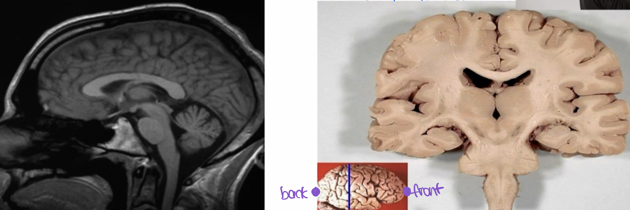 <ul><li><p>Understanding the planes is important in using _______.</p></li><li><p>Newer _________ create ______ images.</p></li><li><p>Cross section of tissue looks very diff from the organ or body part from where it’s taken.</p></li><li><p>Knowing how to cut the tissue is very important to understanding what you’re looking at in diagnosing disease.</p></li></ul>